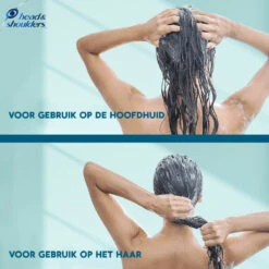 6x Head & Shoulders Conditioner DERMAxPRO 13 6x Head & Shoulders Conditioner DERMAxPRO -Plein 1068946 6