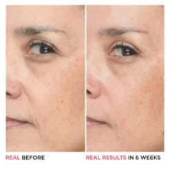 IT Cosmetics Bye Bye Lines Hyaluronic Acid Serum 11 IT Cosmetics Bye Bye Lines Hyaluronic Acid Serum -Plein 1072752 5