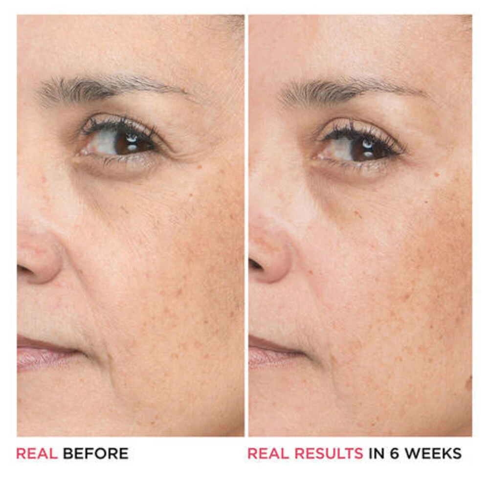 IT Cosmetics Bye Bye Lines Hyaluronic Acid Serum 7 IT Cosmetics Bye Bye Lines Hyaluronic Acid Serum - Afbeelding 5