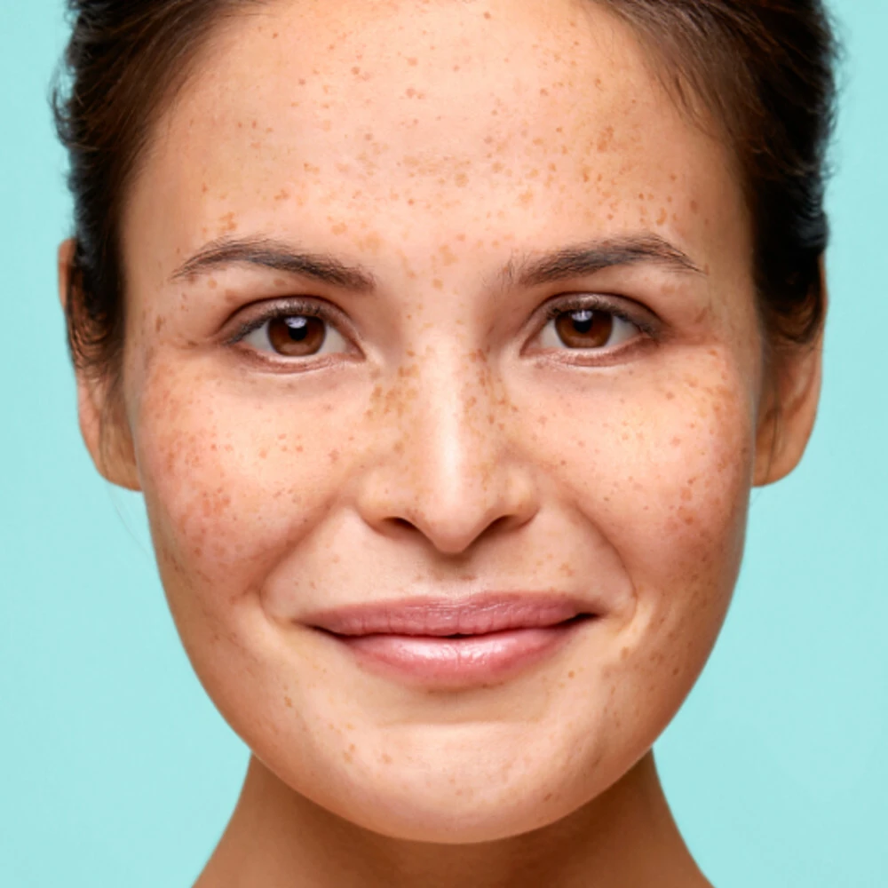 Biodermal Face Gel 4 Biodermal Face Gel - Afbeelding 2